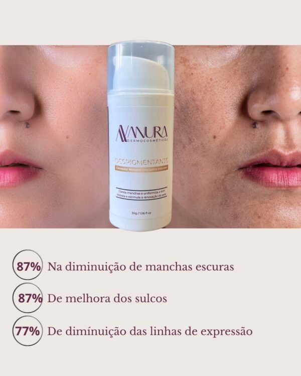 Despigmentante Clareador Noturno Melasma Solution - Image 2